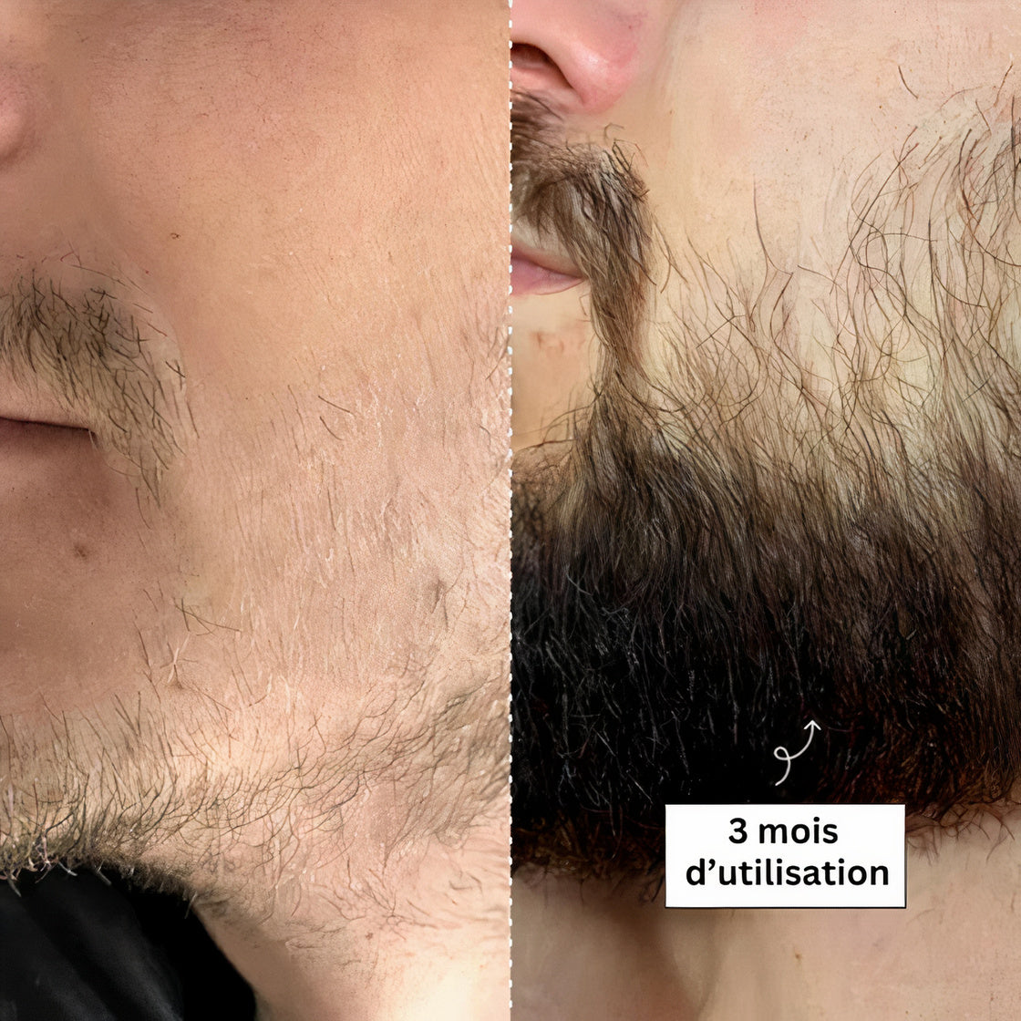 Viking Set | Professionelles Bartstoppler-Set