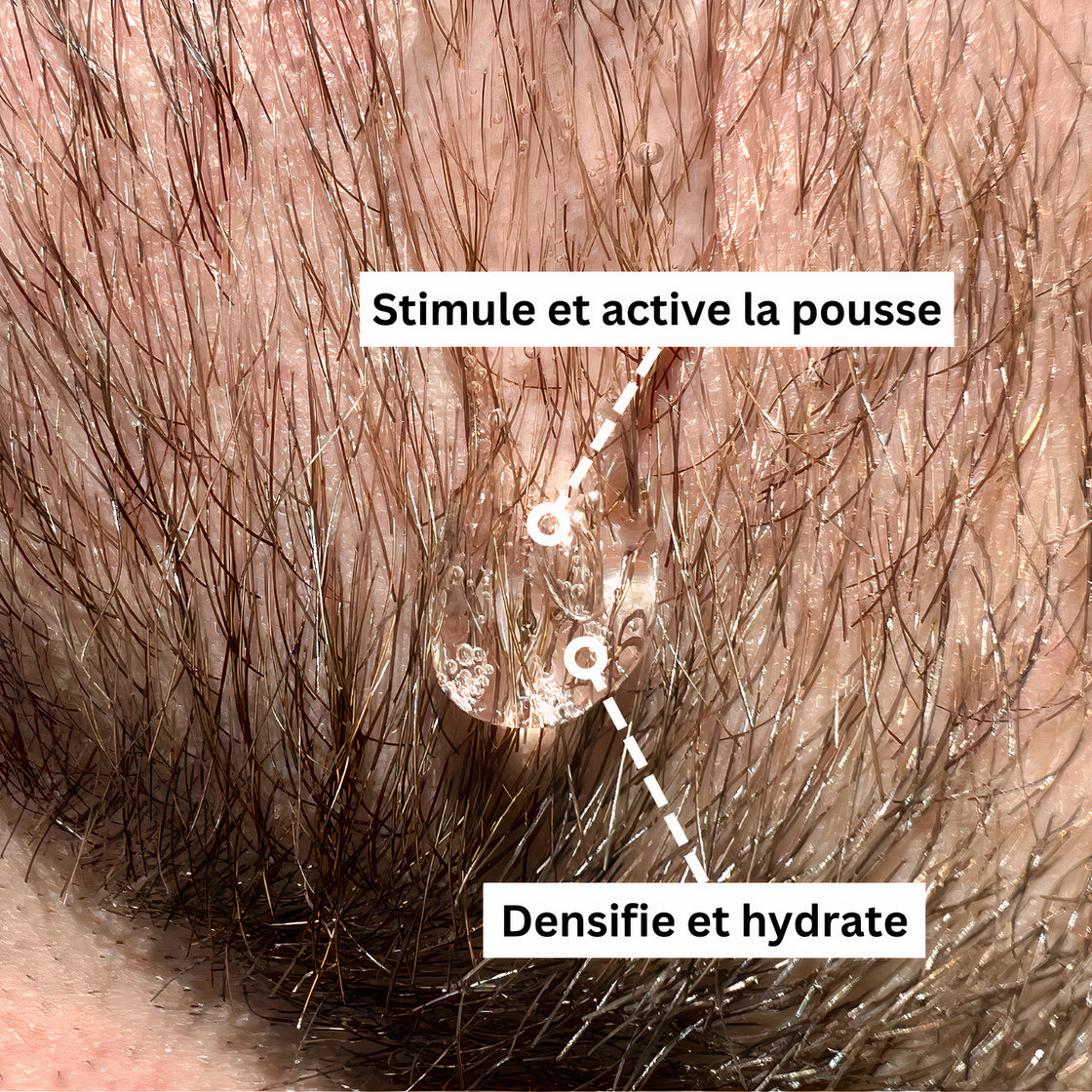 Activator Serum | Booster Bartwuchs