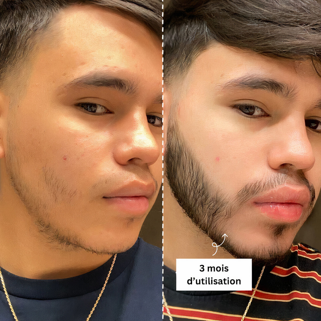 Thorin Serum | Bartwuchsöl